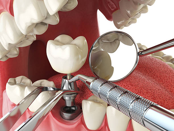 Best Emergency Dentist for Special Needs Patients in Auburn, IL